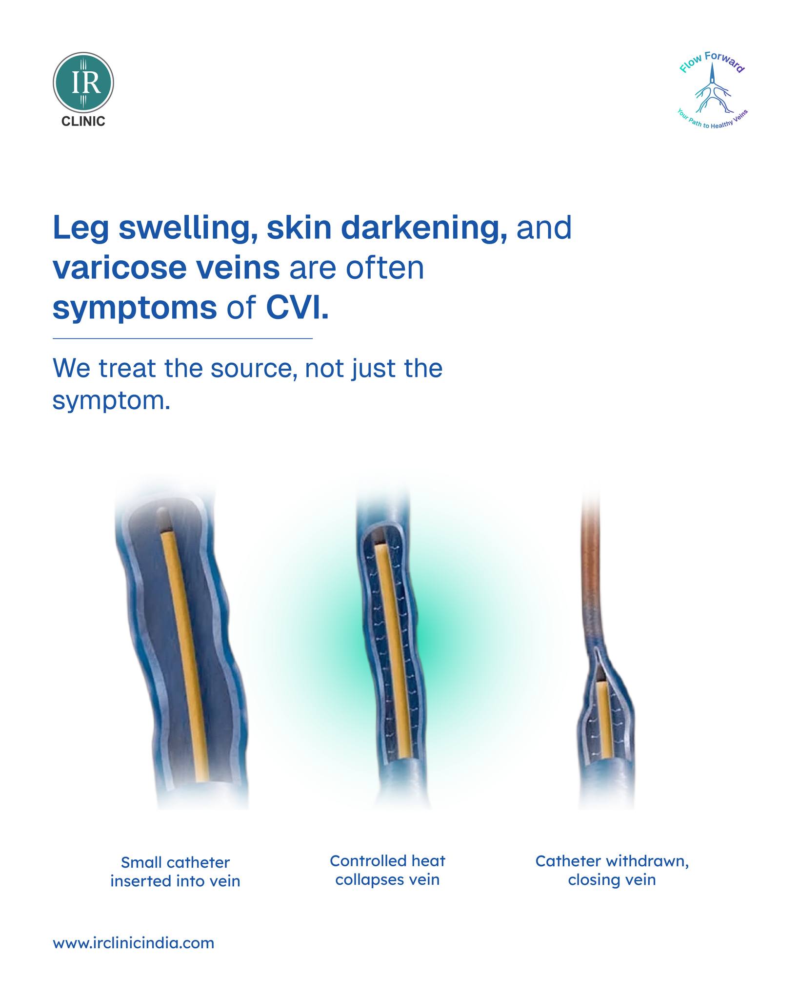IR Clinic India - Leg swelling, skin darkening, and... | Facebook
