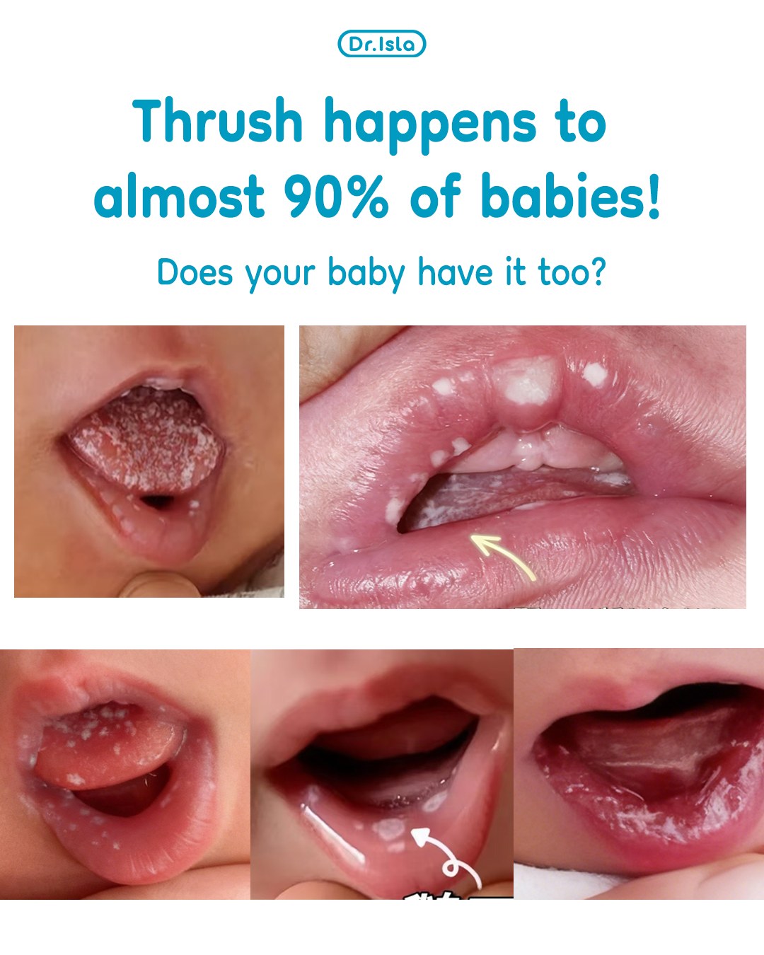 Are newborn skin issues really... - Dr.isla Philippines | Facebook