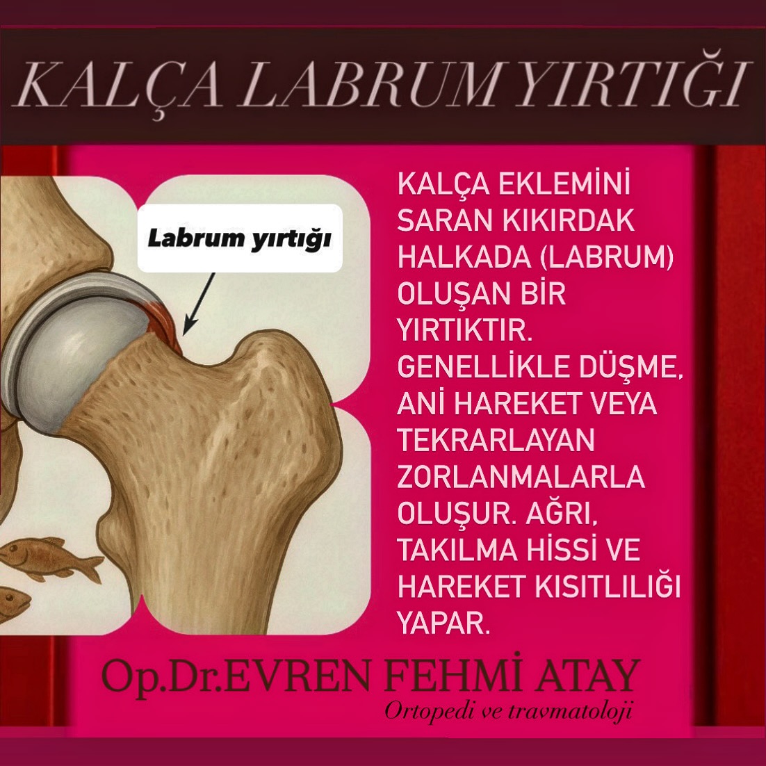 Dr. Evren Fehmi Atay | Istanbul