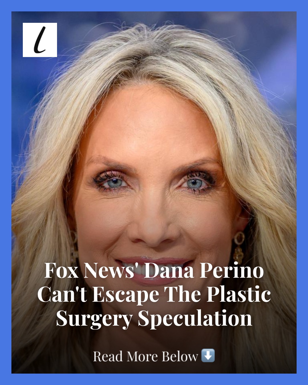 dana perino plastic surgery Image 6