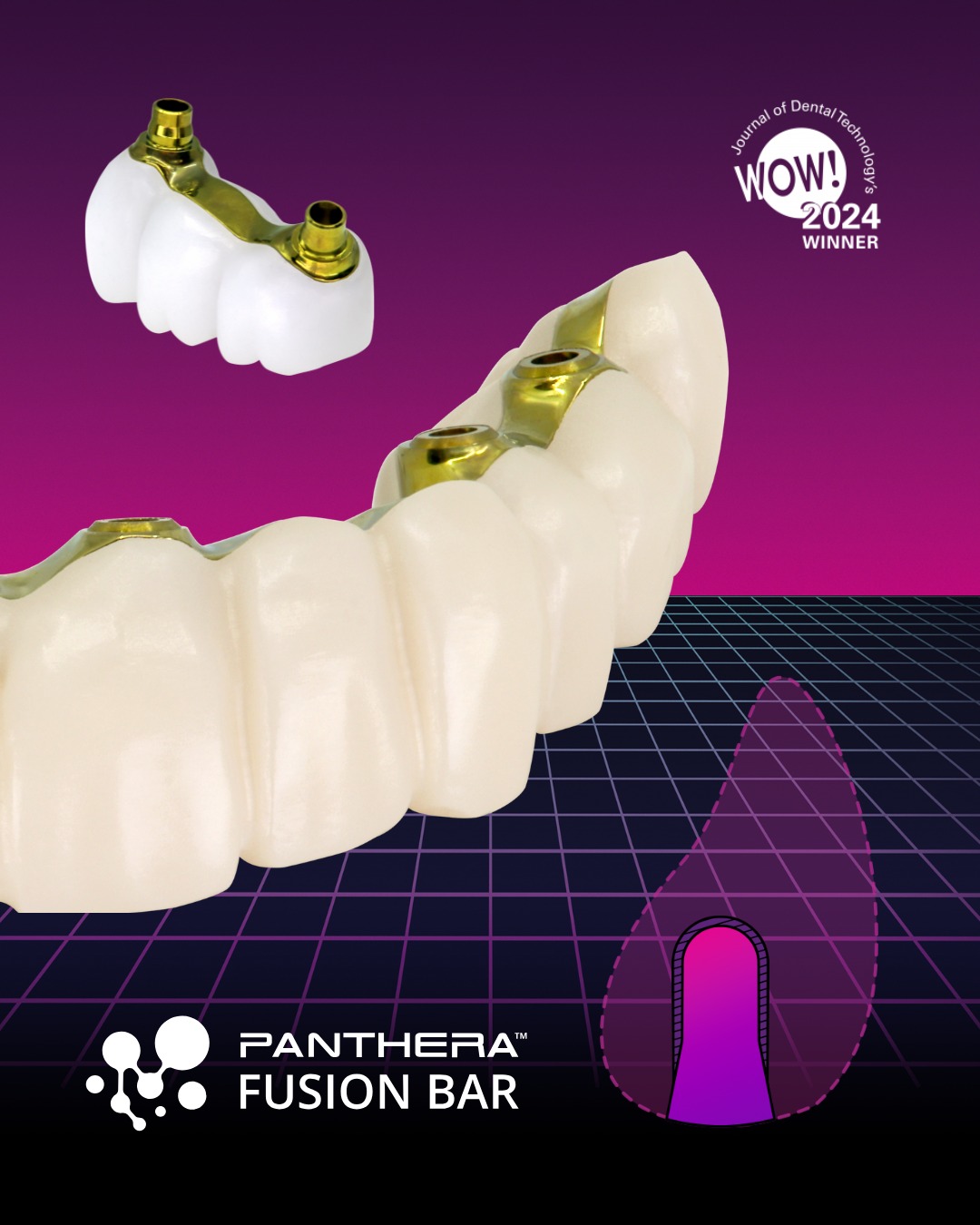 Panthera - 🚀 New from Panthera Dental! Introducing the PFB™️ Bridge ...
