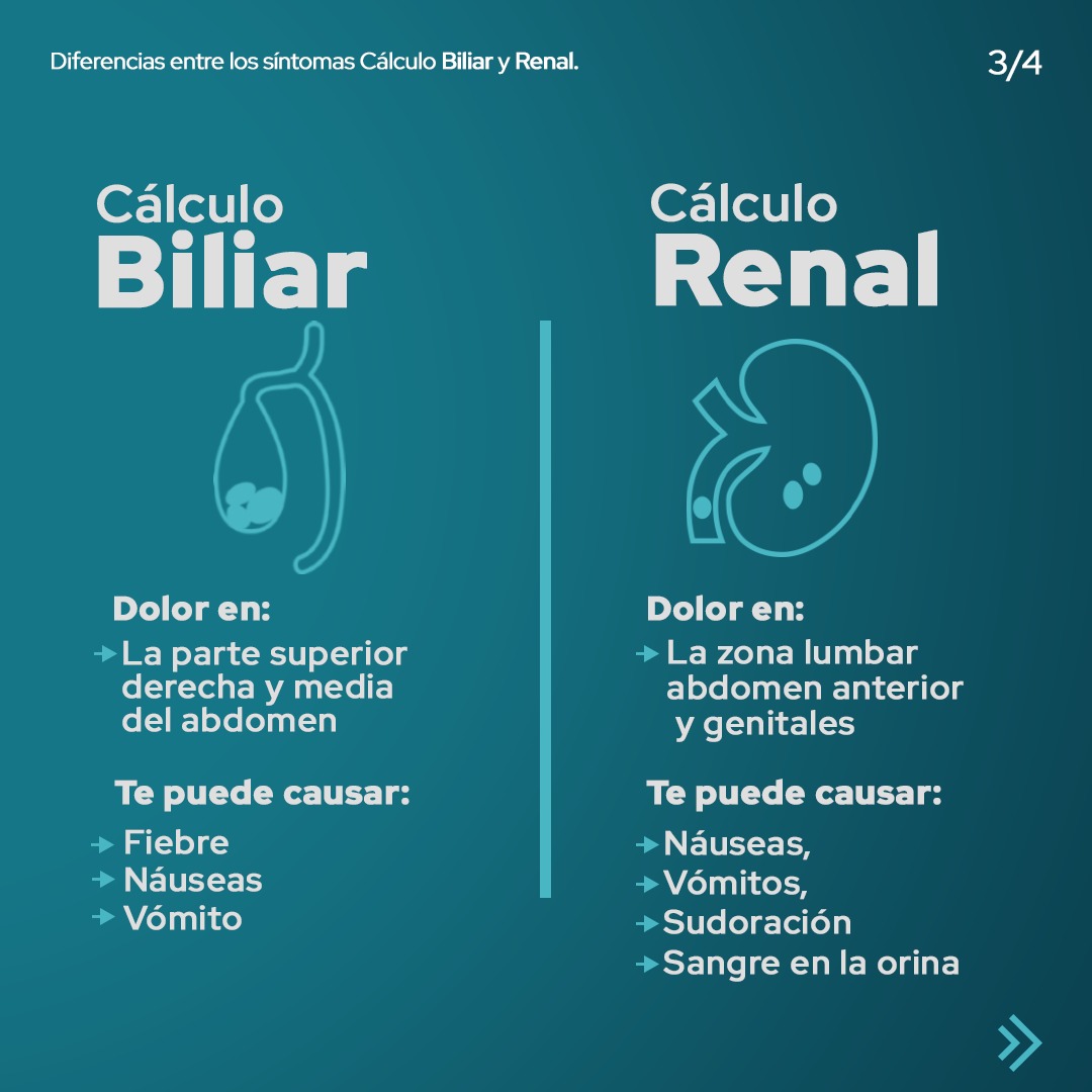 ¿Los cálculos biliares y renales son iguales? 🤷‍♂️ ¡No! 🙅‍♂️ 👇En este ...