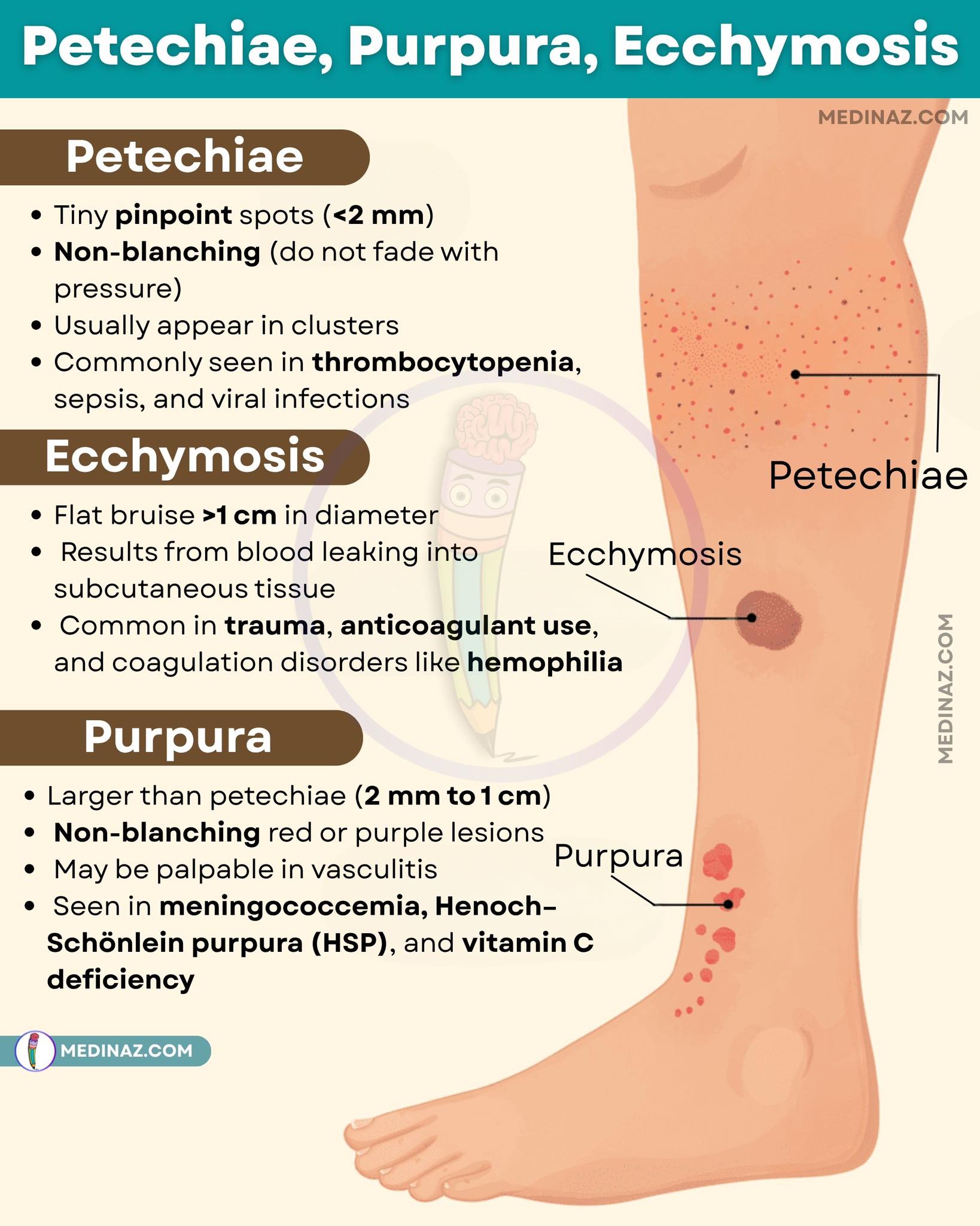 Medinaz - Petechiae, Ecchymosis & Purpura | Facebook