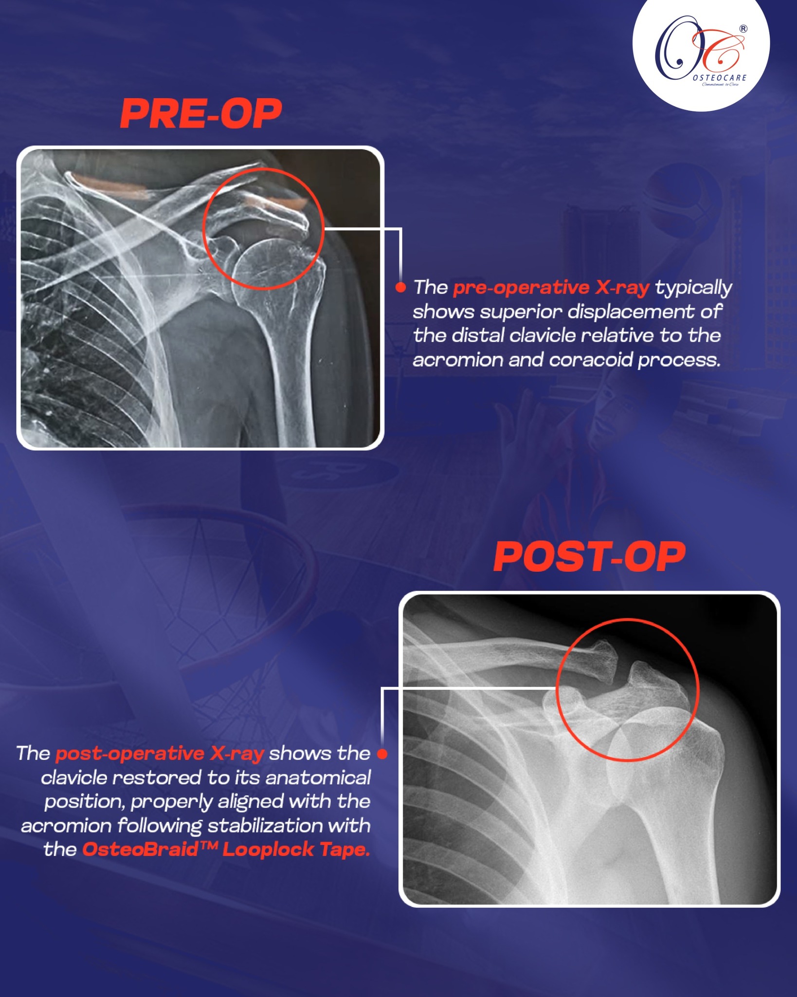 Osteocare Medical | Ahmedabad