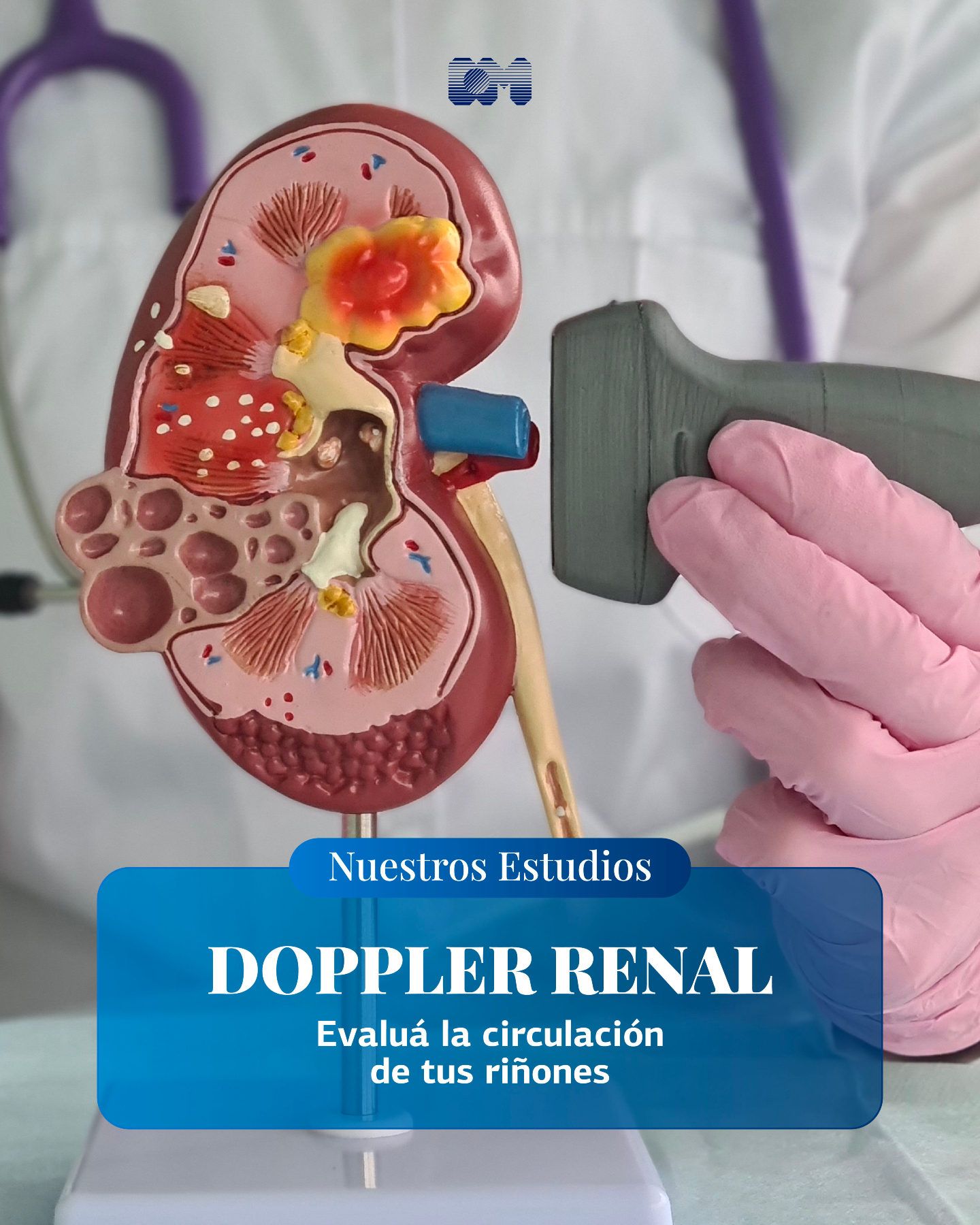 Investigaciones - El Doppler renal es un estudio no invasivo que ...