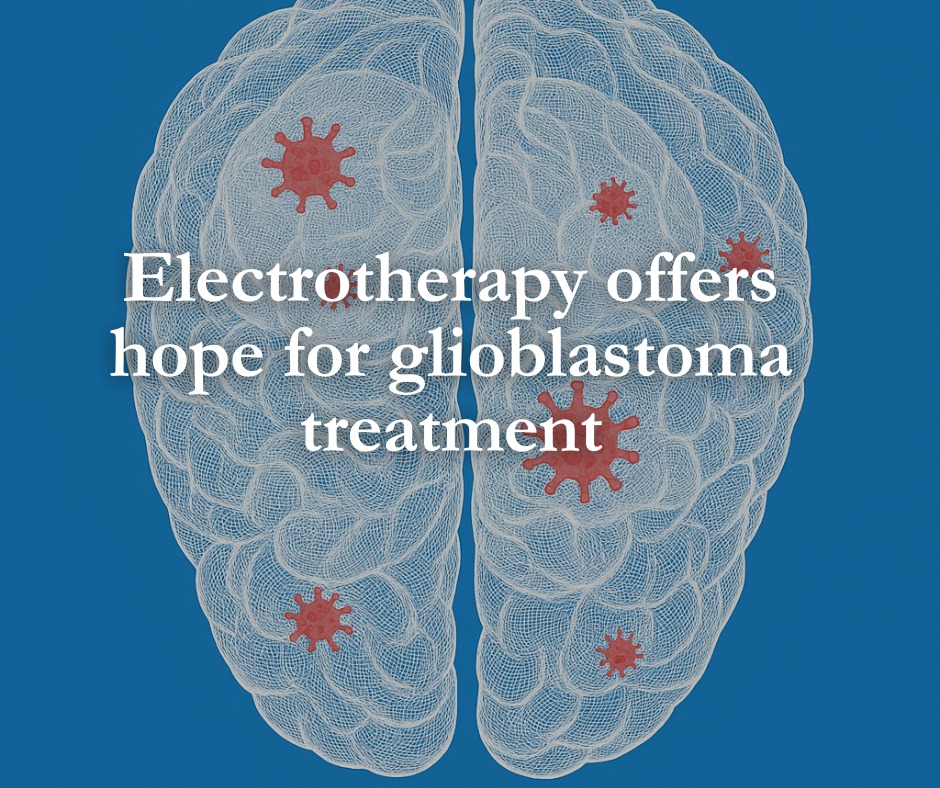 Lund University - New hope for glioblastoma treatment!... | Facebook