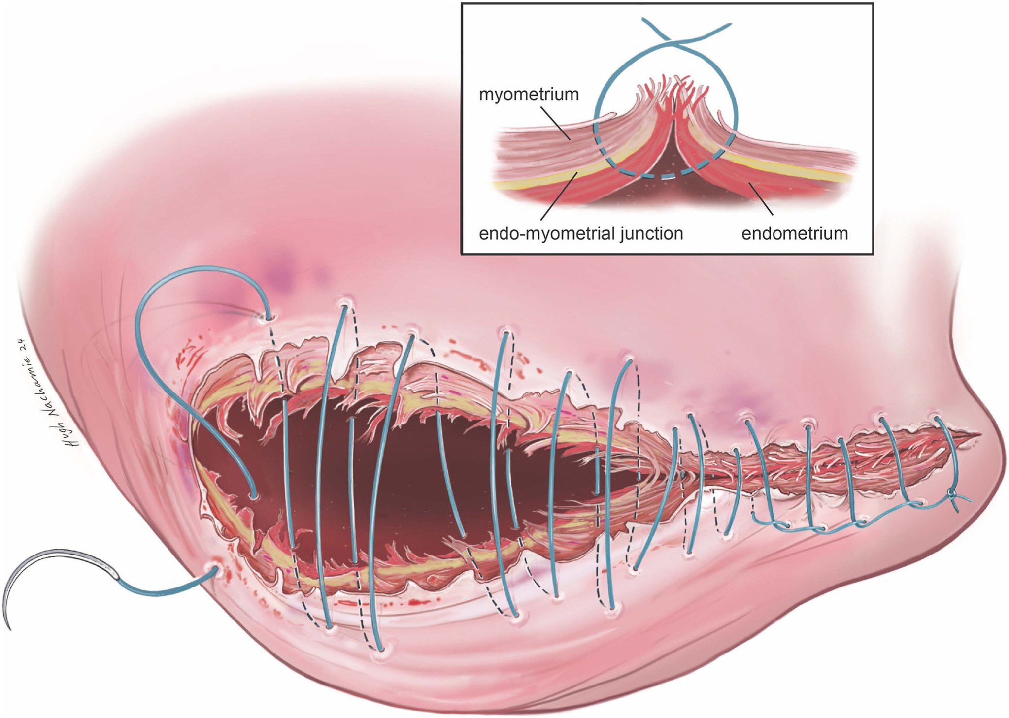 AJOG Expert... - American Journal of Obstetrics & Gynecology | Facebook
