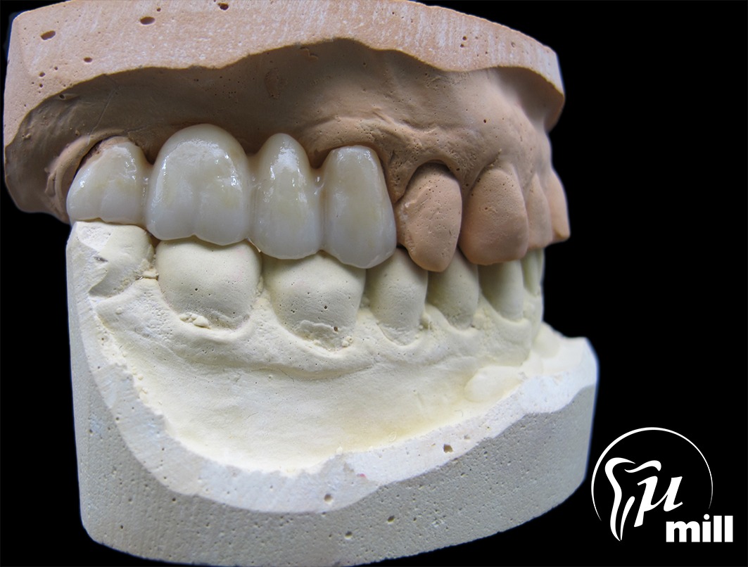 Umill - We’re excited to share that our lab offers full staining and ...
