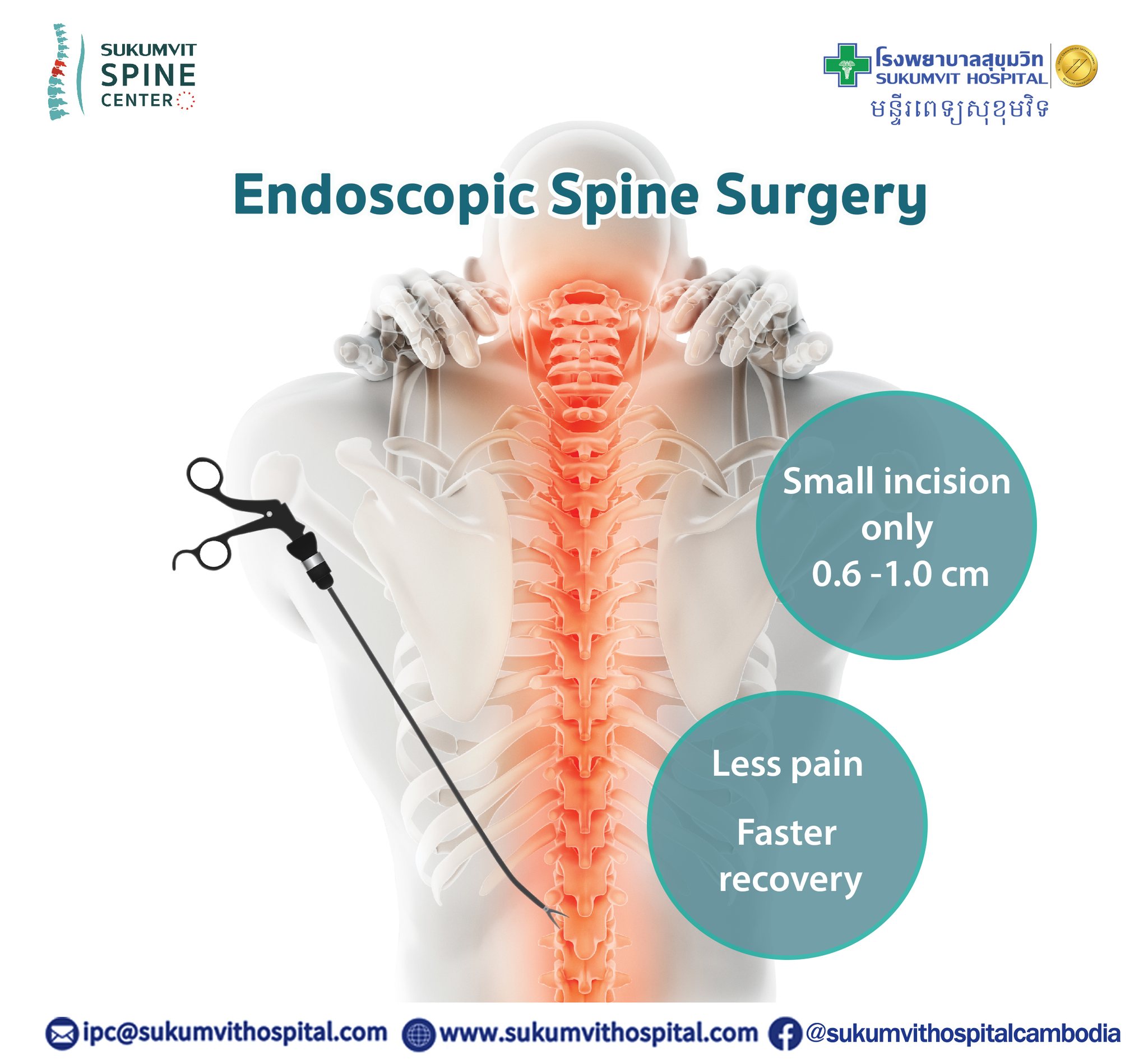 Sukumvit Hospital, Thailand មន្ទីរពេទ្យសុខុមវិទ - Endoscopic Spine ...