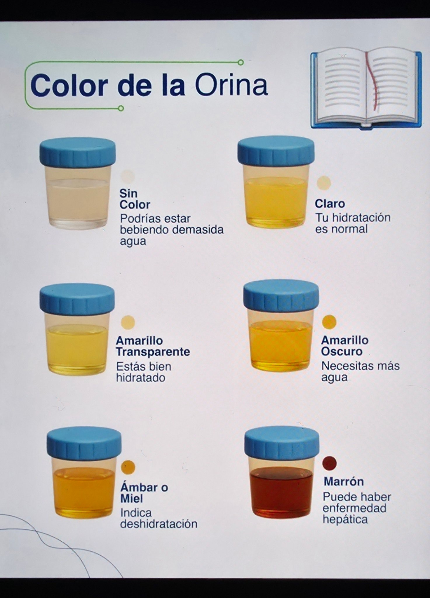Tus - Información Importante 👇 Conoce el Color de la Orina y su ...