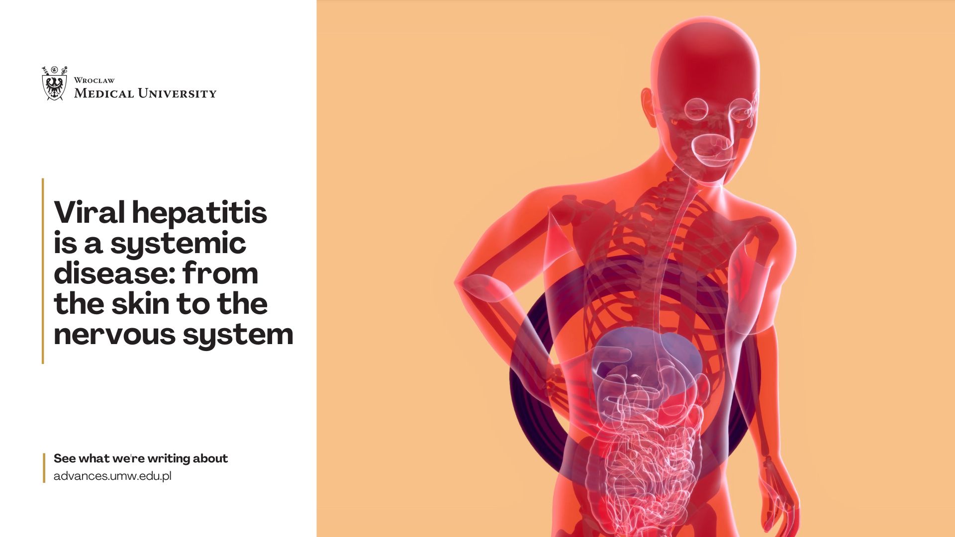 Advances - 🧬 Hepatitis C – more than a liver disease For decades ...
