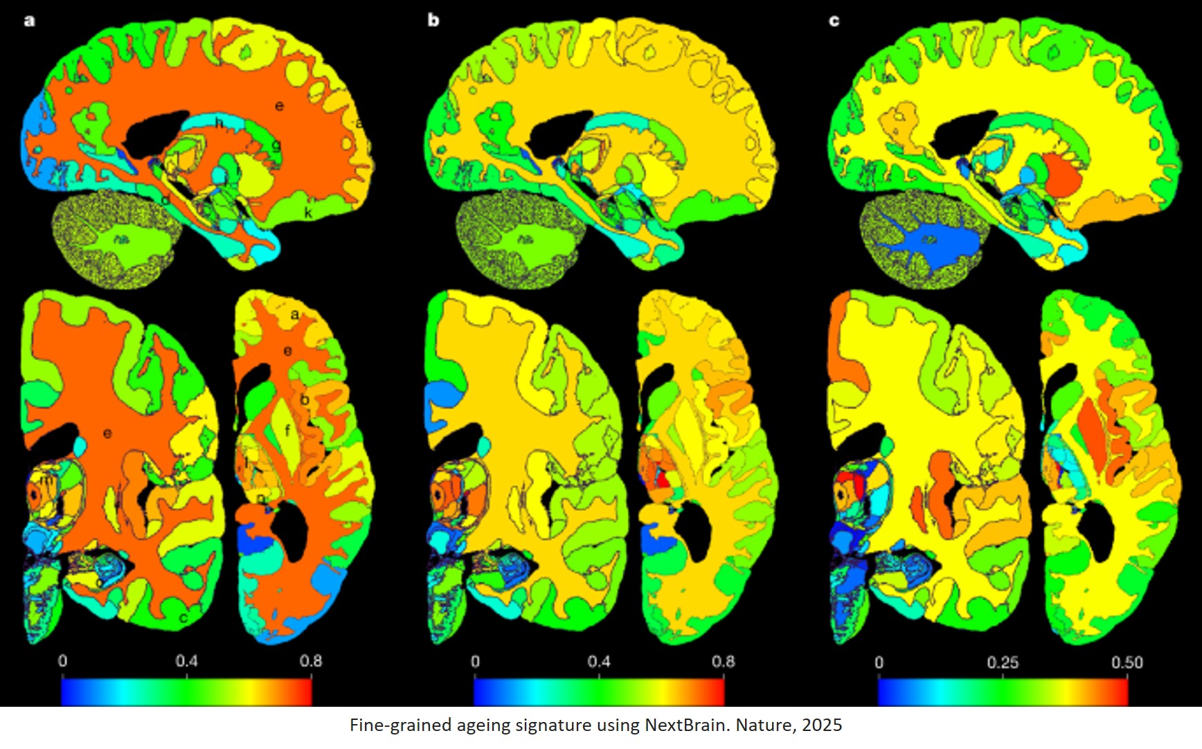 Science - A new atlas of the human brain The atlas took the research ...