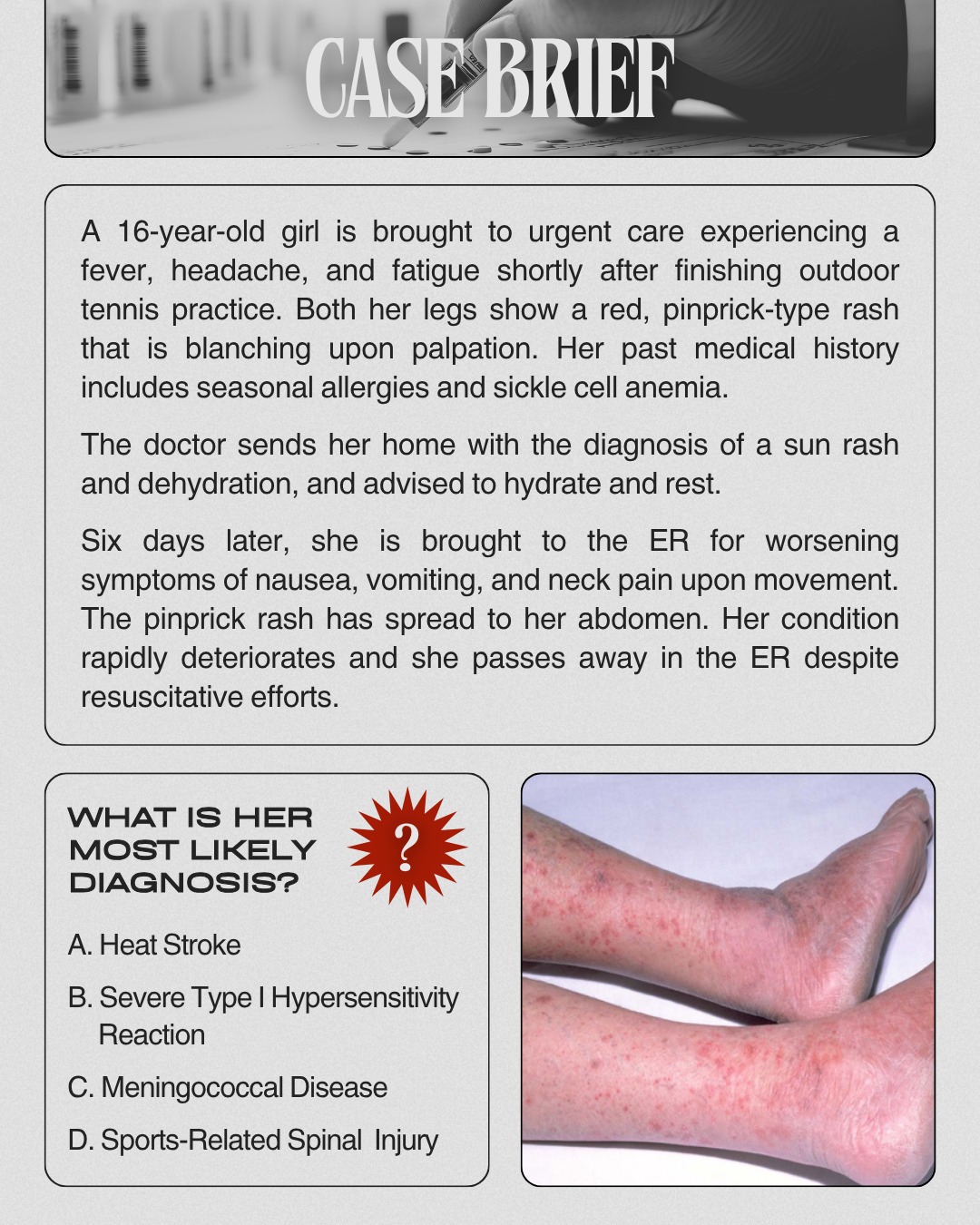 DeKalb - (Belated) Medical Student Monday 🍎 Case Brief 🔍: A 16-year-old ...