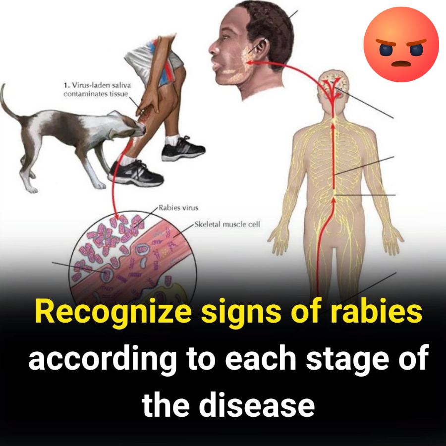 Feedy - Rabies is one of the causes of death of tens of thousands of ...