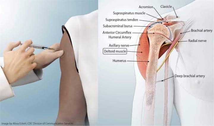 shoulder joint pain after b12 injection Hey all, looking for advice Nature Made Vitamin B12 Preworkout Quantity:1 Bottle