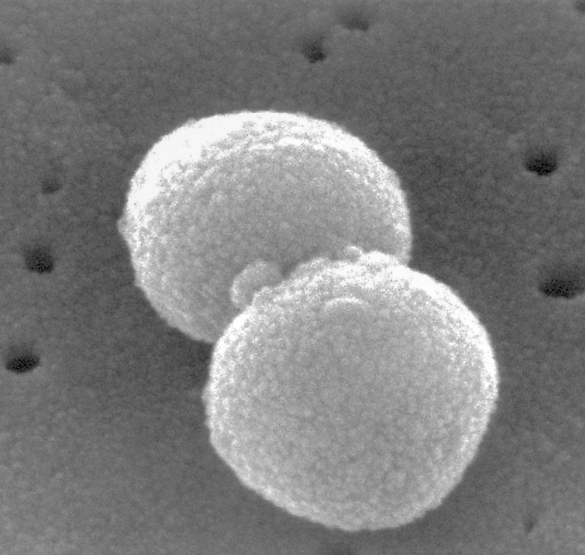 M.A. - Know the difference: On the left: DIPLOCOCCUS • very small ...