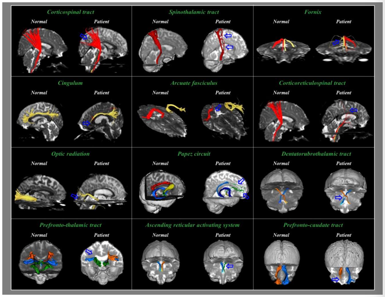 PostGradDC - 🧠 Traumatic Brain Injury: The Crucial Role of... | Facebook