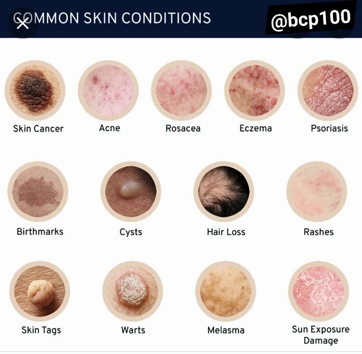 Common skin conditions include... - Biology Physics Chemistry | Facebook