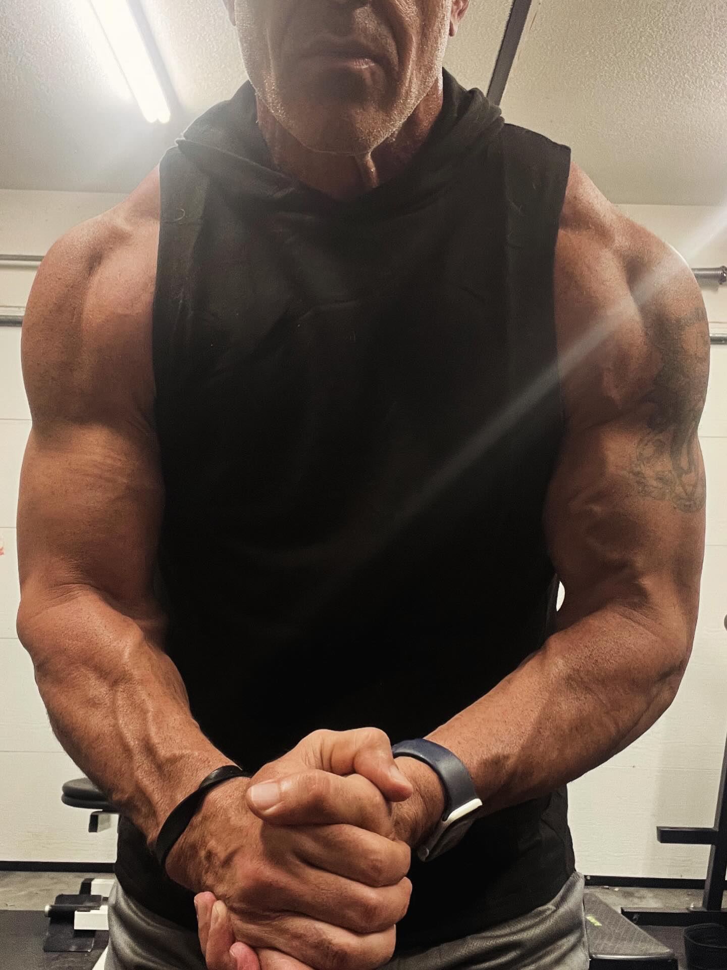 andrew hiller bpc 157 9 days post-op, and Dr Moynihan told me: 'No training for 6 months.' Honestly that hit hard. The gym isn't just something I do, it's who I am. 6 months feels like Methylation Buy More and Save:5 Box Deal $219.00 SLU-PP-332
