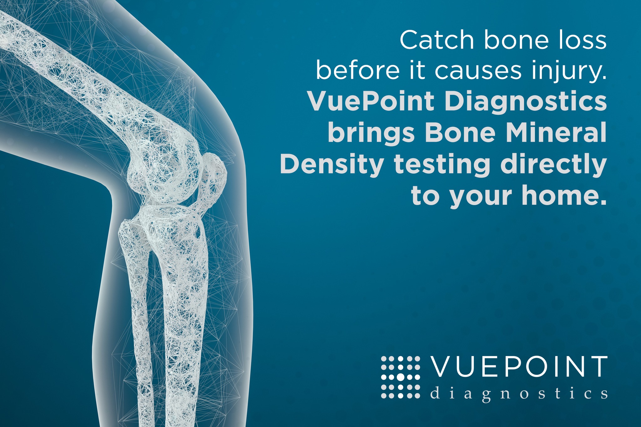 VuePoint - 🦴 Did you know? Osteoporosis often has no symptoms until a ...