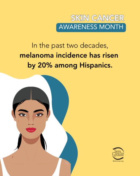 South - Skin cancer can affect anyone, regardless of skin tone. Early ...