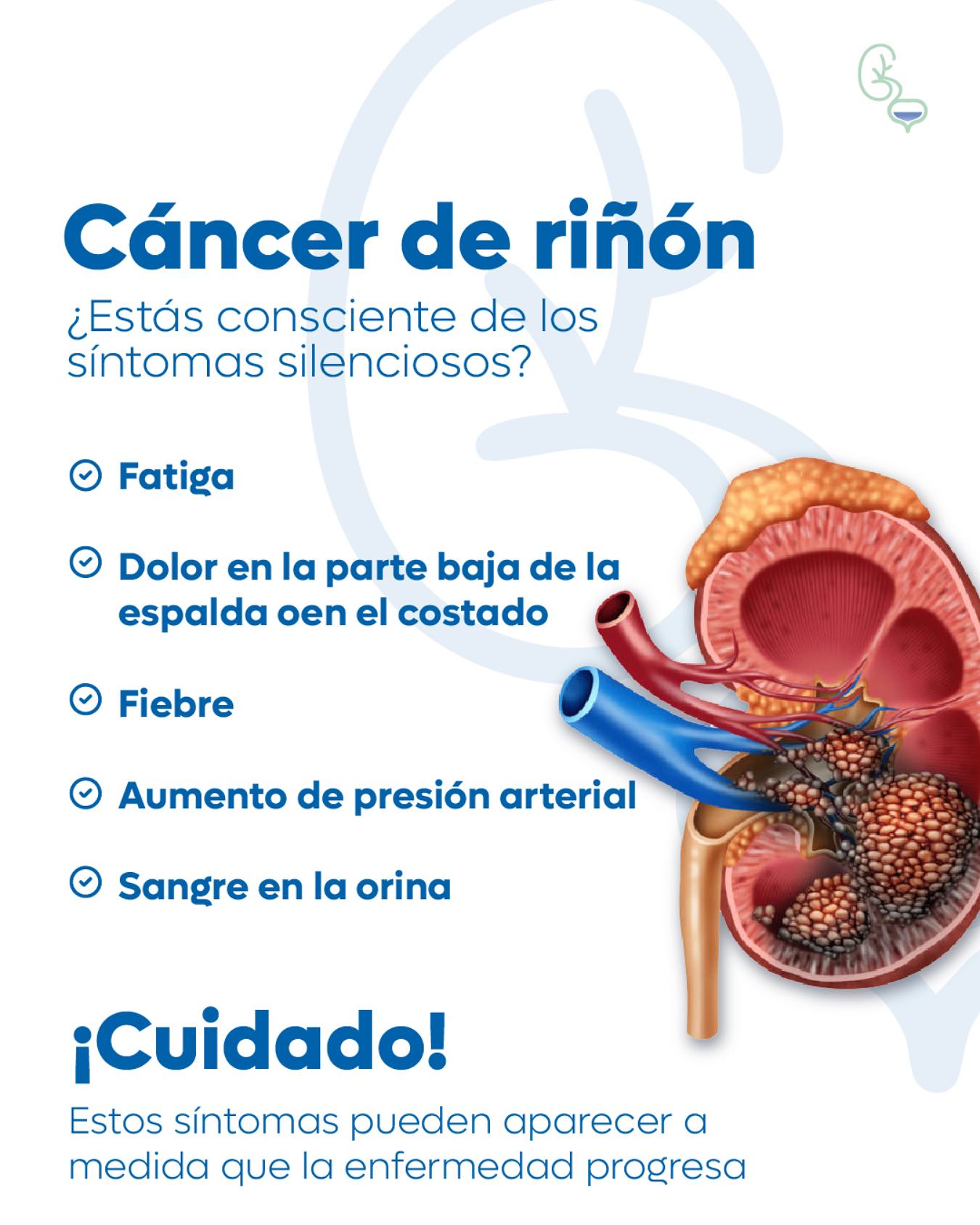 Urologia - 🚨Atención a tu salud renal El cáncer de riñón a menudo se ...