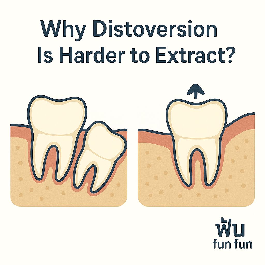 ฟัน - Question : ทำไมฟันคุด distoversion ถึงเอาออกยากกว่า mesioversion ...