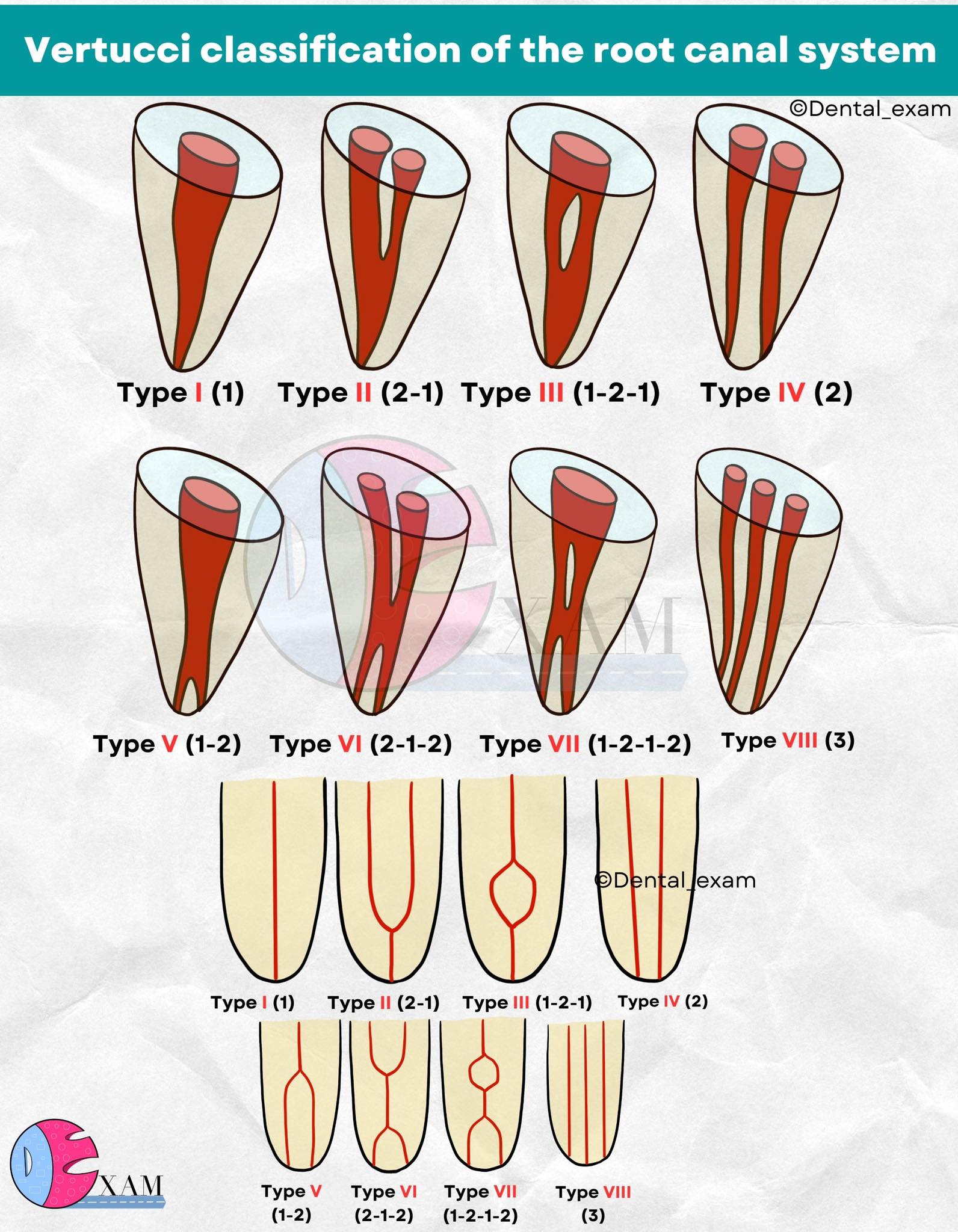 Dental - Root canal system | Facebook