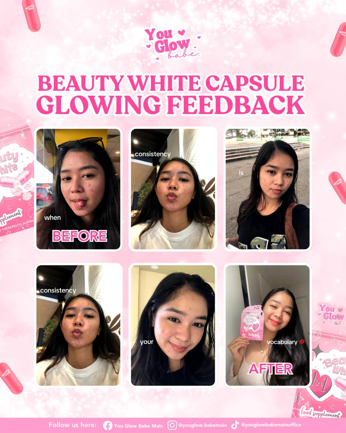 bea skin clinic glutathione Ever wonder how to achieve glowing skin? 🤔 Beauty White Capsule holds the answer. It's a 4-in-1 blend of Glutathione, Collagen, Vitamin C, and Garcinia Cambogia. It brightens, hydrates, firms, and supports How our glutathione supplement ANAIRUI Copper Peptides GHK-Cu cris detox Size:25 mL