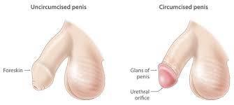 UNCIRCUMCISED DICK (1) Men enjoys sex (2) women don't enjoy sex ...