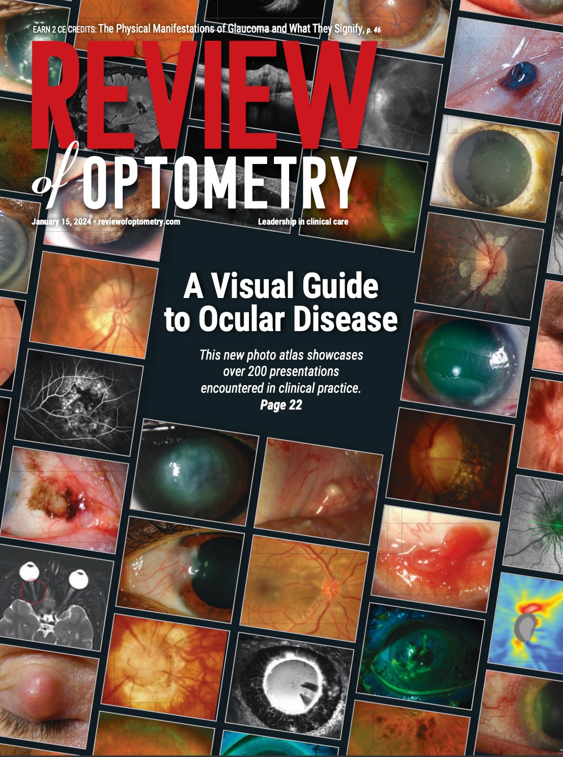 The Review of Optometry Photo Atlas... - Review of Optometry