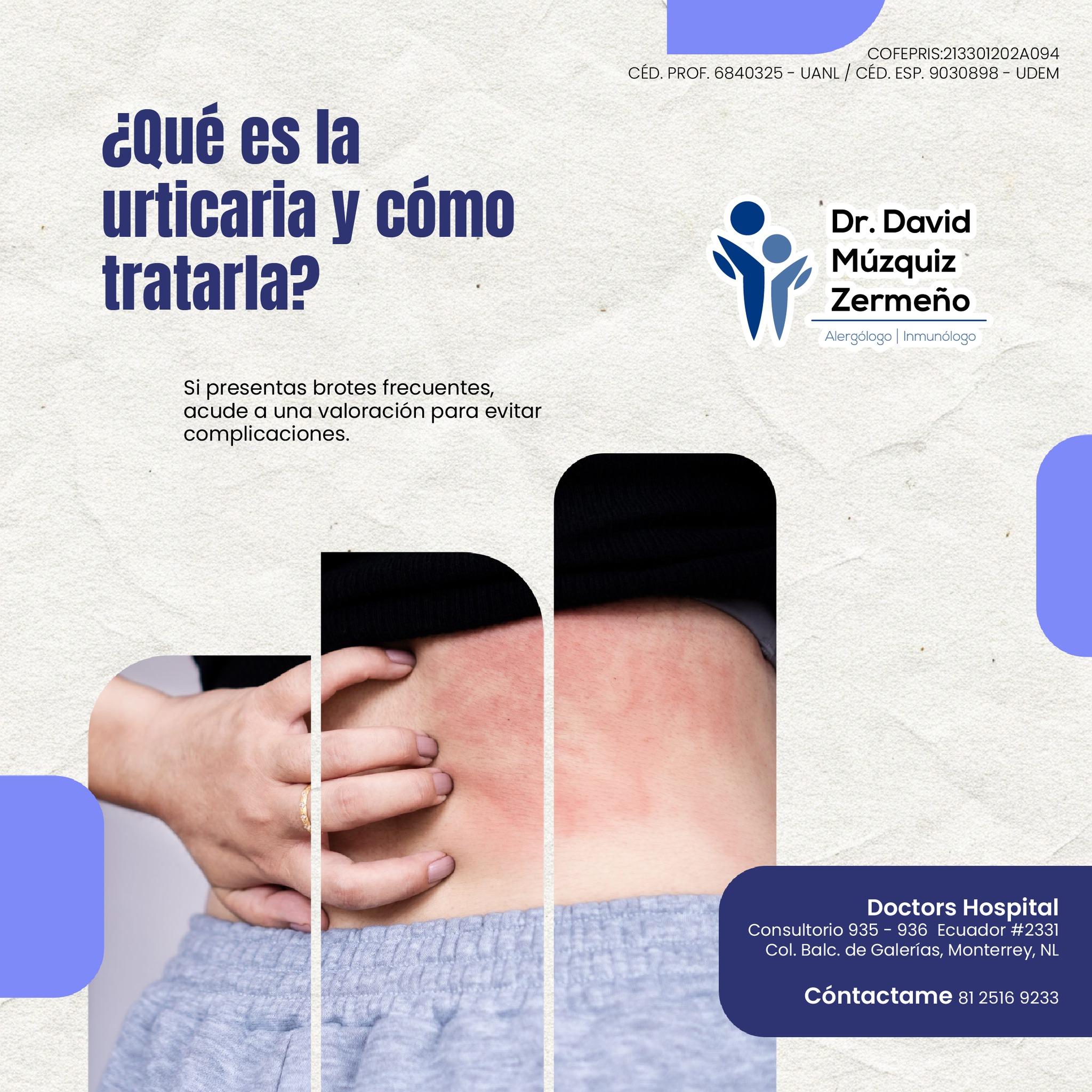 Alergologo - ¿Qué es la urticaria y cómo tratarla? La urticaria son ...