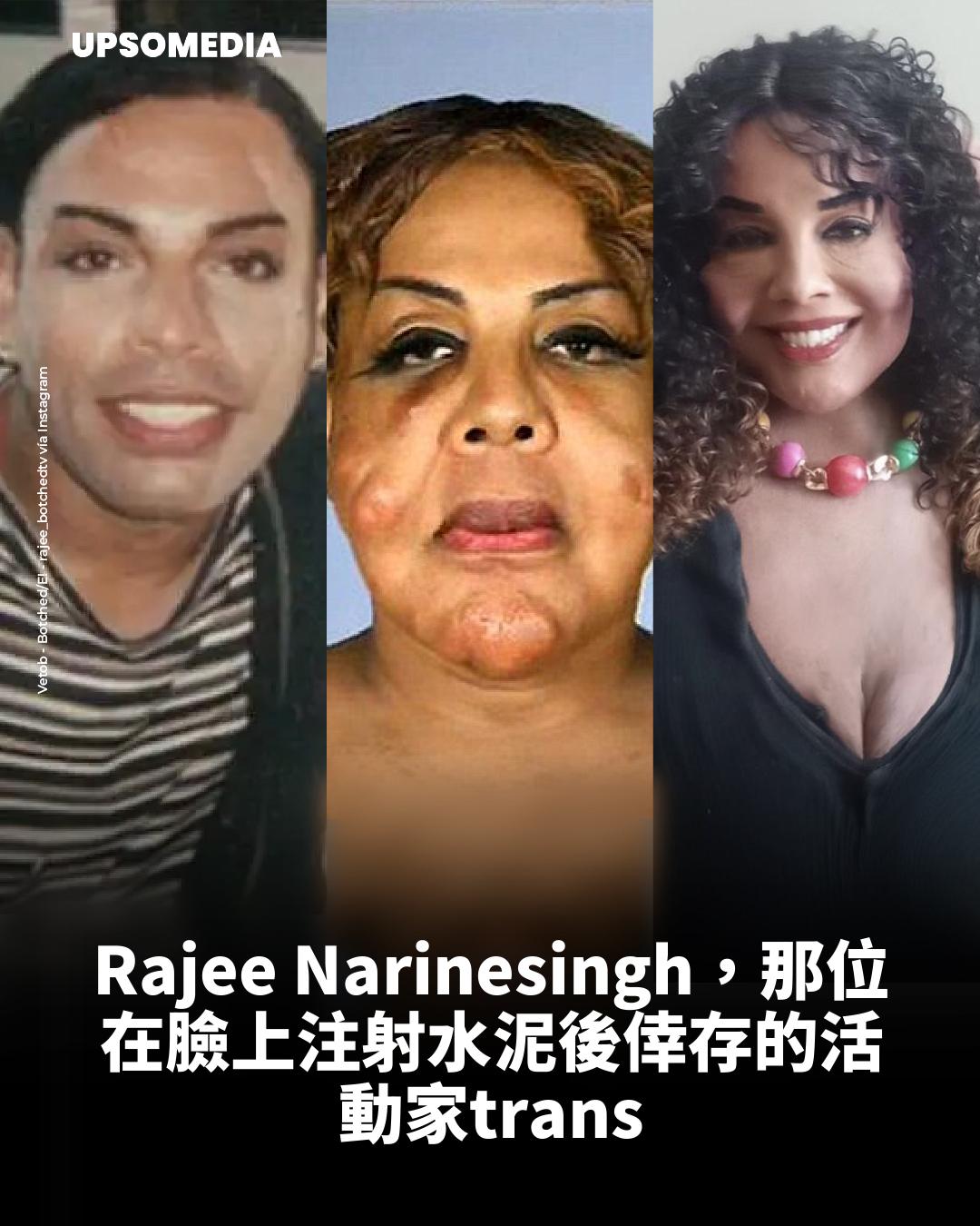 樂觀 - Rajee Narinesingh，一位美國的跨性別女性、演員和作家，在2005年因接受非法美容手術而遭受嚴重毀容，從而引起廣泛關注 ...