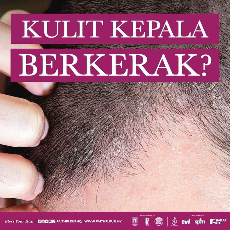 Bagi anda yang ada masalah rambut... - FaithFleur Sandakan | Facebook