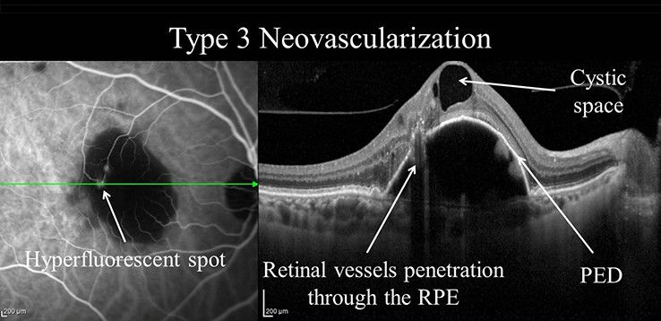 Ophthalmology-Notes And... - Ophthalmology-Notes And Synopses