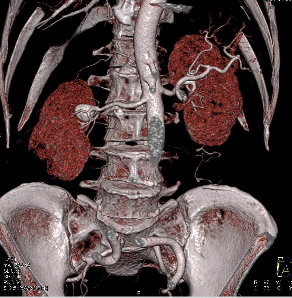 CTisus: Cutting edge information on body CT (Computed tomography ...