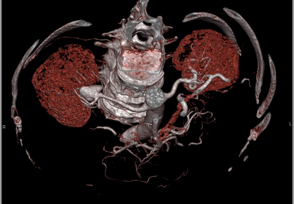 CTisus: Cutting edge information on body CT (Computed tomography ...