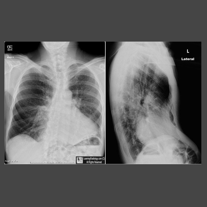 LearningRadiology - LearningRadiology.com Case of the Week 1,191 is a ...