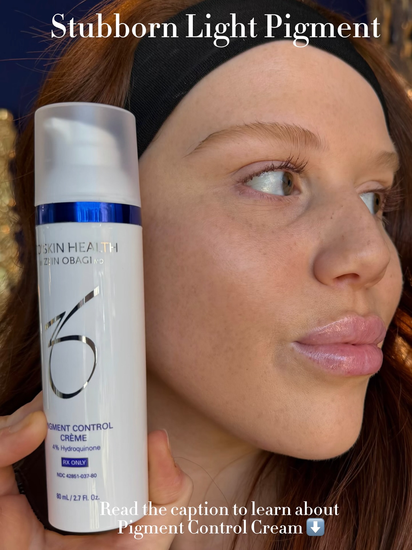 Say goodbye to stubborn pigment without the irritation! ✨ ZO Skin 
