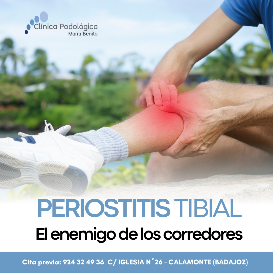 Clínica - 🏃‍♂ ¿Dolor en la tibia? ¿Molestias cuando corres? Podrías ...