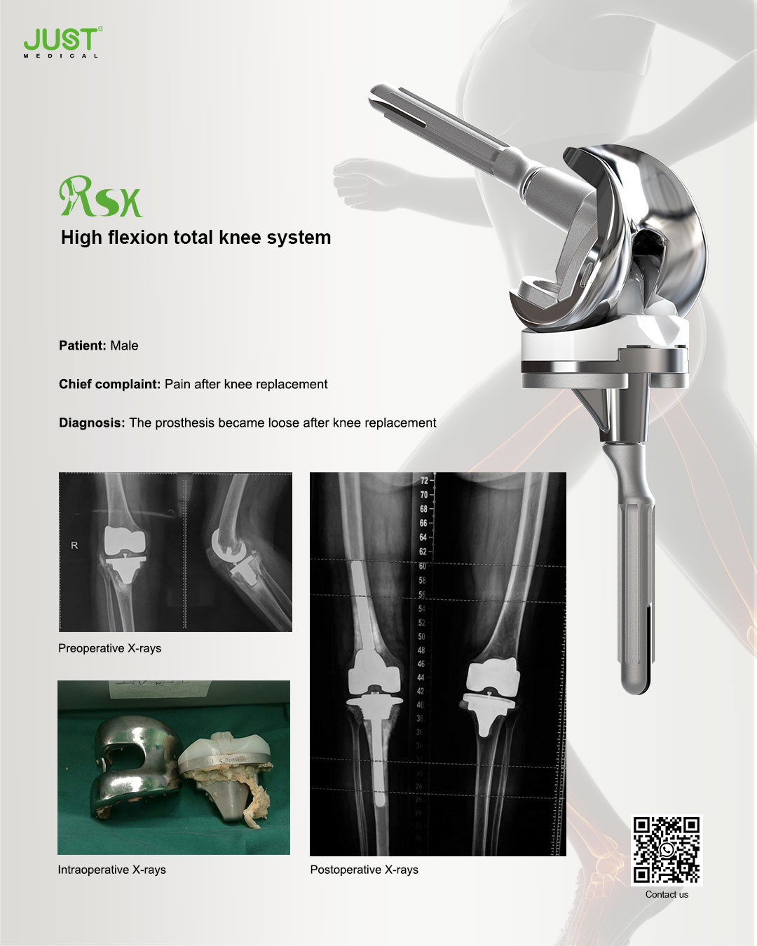 JUST Medical- Hip & Knee implants manufacturer | Nankai