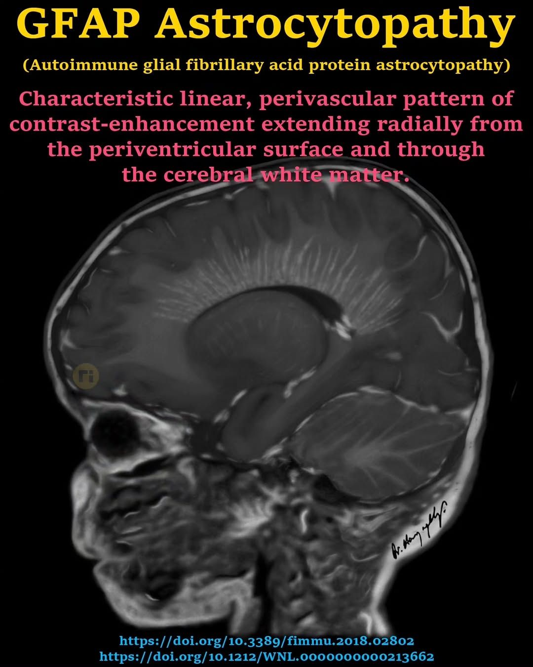 Radiology Students Of A.M.S - MAGIC DR This helps me r/o non infectious ...