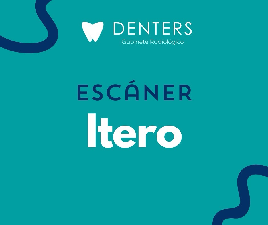 Denters - El escáner intraoral iTero™️ está diseñado para ofrecer ...