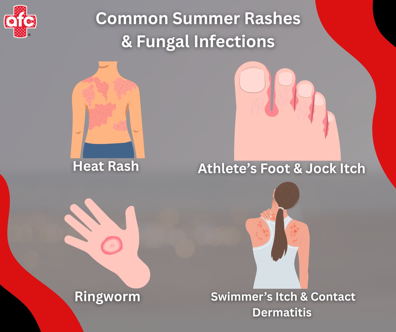 AFC - 🌞 Summer Rashes & Fungal Skin Infections to Watch Out For! Hot ...