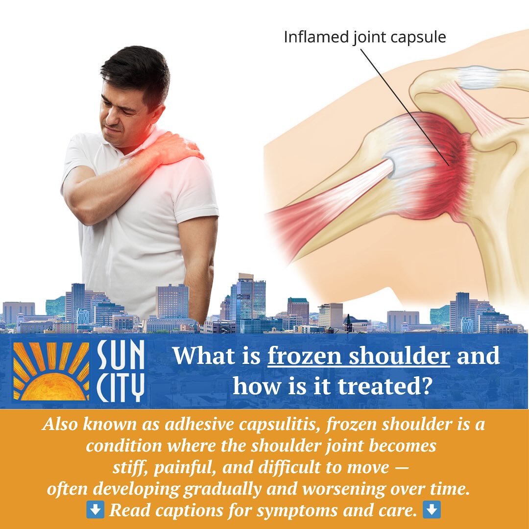 Sun - 🧊 What Is Frozen Shoulder? 🧊 Also known as adhesive capsulitis ...