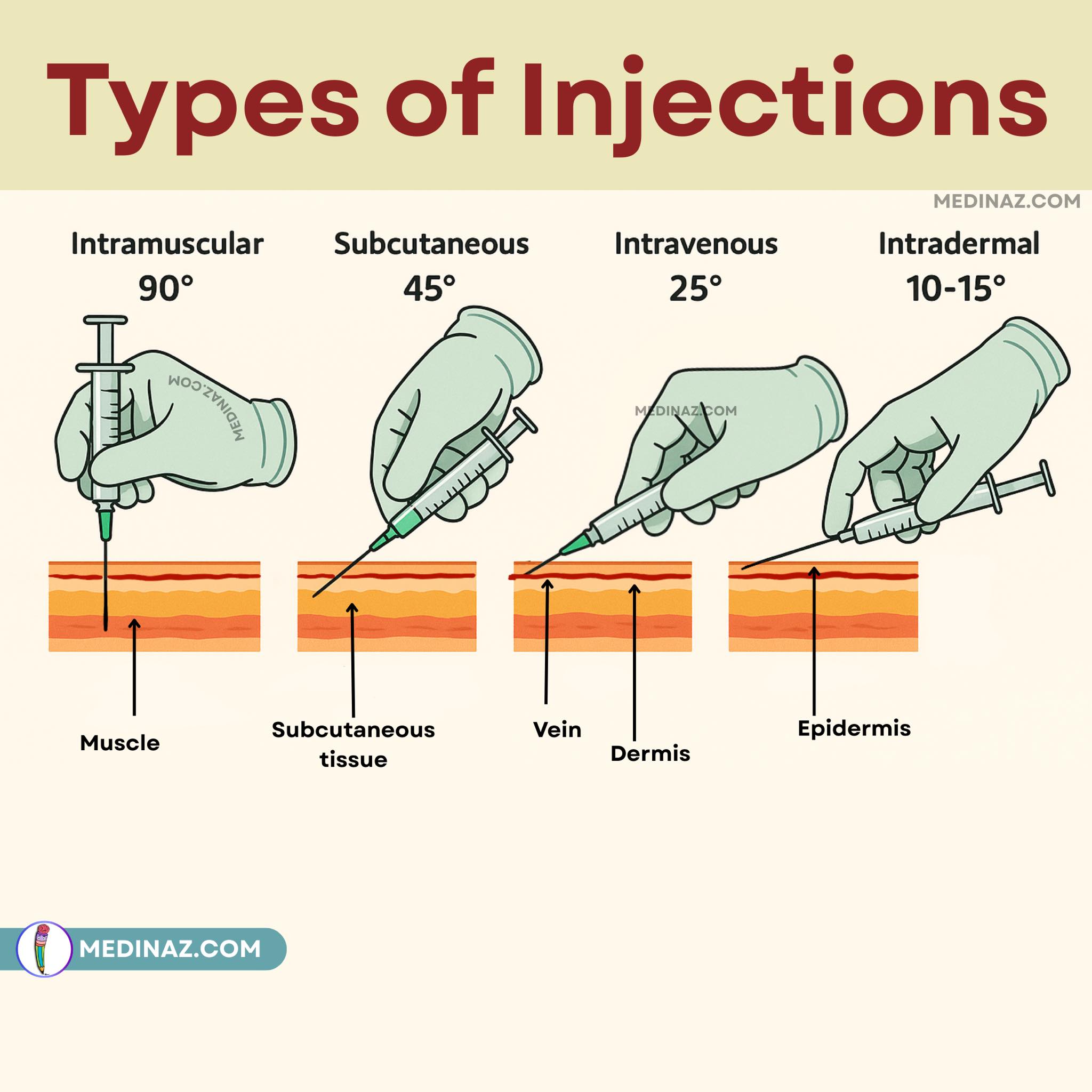 Medinaz - Types of injections | Facebook