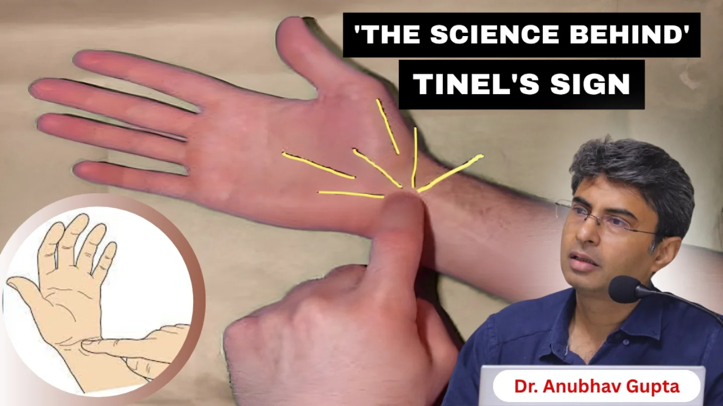 Understanding Tinel’s Sign & Its Clinical Significance | Dr. Anubhav ...