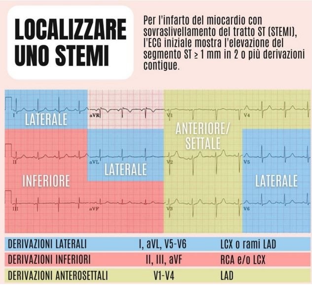 infermiere-stemi-o-nstemi-l-ecg-pu-salvare-una-vita-quando