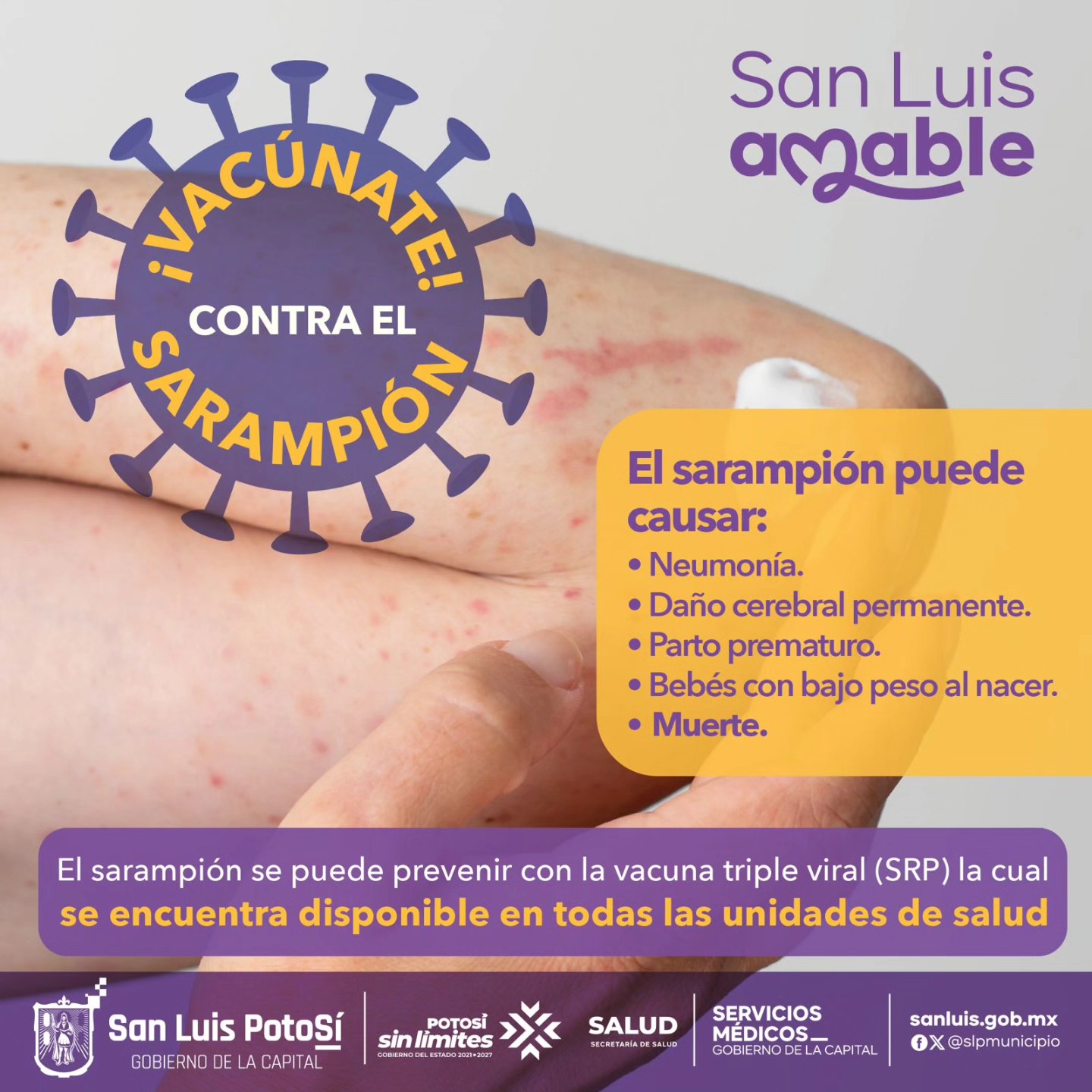 Gobierno - 🛡️El sarampión es una enfermedad muy contagiosa 🤧 que puede ...