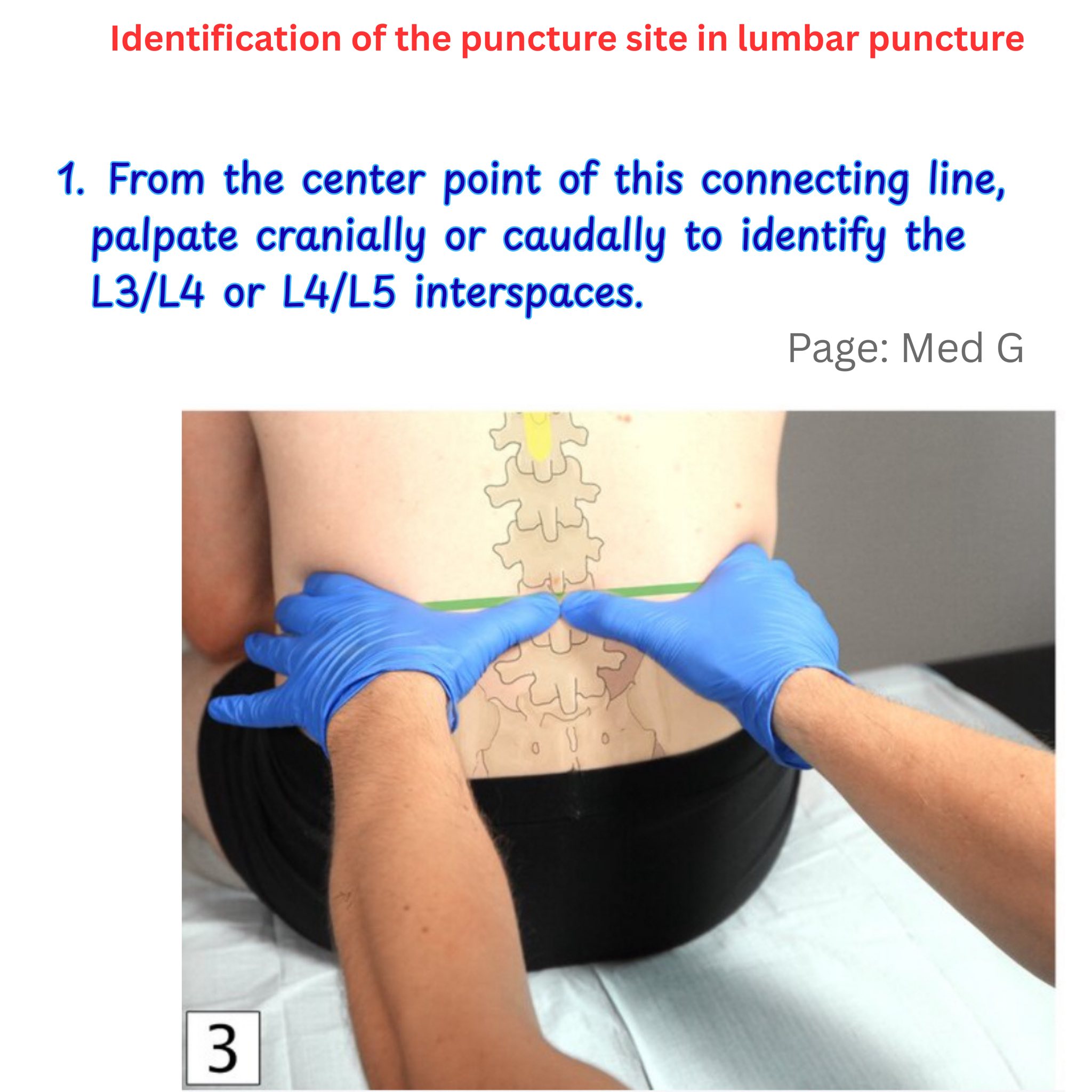Med G - Lumbar puncture (LP) is a diagnostic and/or... | Facebook